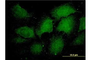 Immunofluorescence of monoclonal antibody to PSMA1 on HeLa cell. (PSMA1 anticorps  (AA 1-263))