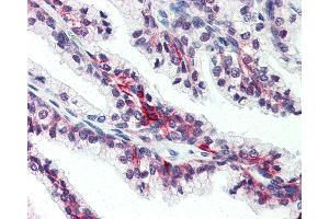 Anti-SLC39A6 antibody IHC of human prostate. (SLC39A6 anticorps  (Internal Region))