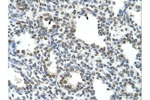 Immunohistochemistry (IHC) image for anti-Naked Cuticle Homolog 1 (NKD1) (N-Term) antibody (ABIN310131) (NKD1 anticorps  (N-Term))