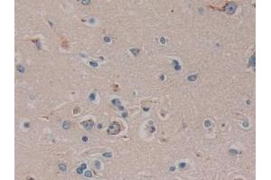 Detection of FAM3C in Human Cerebrum Tissue using Polyclonal Antibody to Family With Sequence Similarity 3, Member C (FAM3C) (FAM3C anticorps  (AA 25-227))