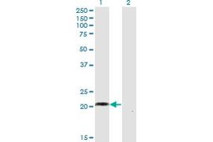 Western Blot analysis of WISP2 expression in transfected 293T cell line by WISP2 monoclonal antibody (M02), clone 1E11. (WISP2 anticorps  (AA 24-250))
