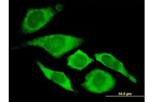 Immunofluorescence of monoclonal antibody to CDKN1A on HeLa cell. (p21 anticorps  (AA 65-164))
