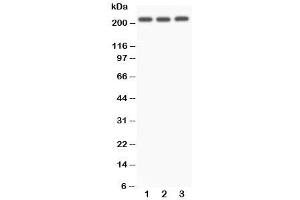 Western blot testing of NOTCH4 antibody and Lane 1:  A549 (NOTCH4 anticorps  (C-Term))