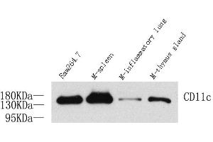 Western Blot analysis of various samples using ITGAX Polyclonal Antibody at dilution of 1:1000. (CD11c anticorps)