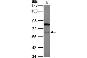 WB Image Sample (20 ug) A: HeLa nucleus 7. (ZNF449 anticorps)