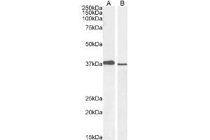 ABIN184999 staining (1µg/ml) of A549 (A) and PD19 (B) cell lysate (RIPA buffer, 30µg total protein per lane). (PCGF2 anticorps  (C-Term))