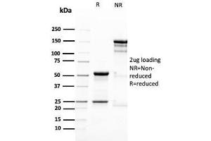SDS-PAGE Analysis Purified Nestin Mouse Monoclonal Antibody (NES/2911). (Nestin anticorps  (AA 698-844))