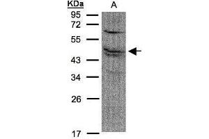 WB Image Sample(30 μg of whole cell lysate) A:A431, 12% SDS PAGE antibody diluted at 1:1500 (FDFT1 anticorps)