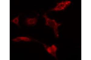 ABIN6274274 staining HuvEc cells by IF/ICC. (GALK1 anticorps  (C-Term))