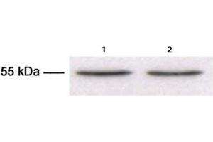 Western Blotting (WB) image for anti-Tubulin, beta 3 (TUBB3) antibody (ABIN1109374) (TUBB3 anticorps)