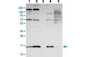 Western blot analysis of Lane 1: RT-4, Lane 2: U-251 MG, Lane 3: Human Plasma, Lane 4: Liver, Lane 5: Tonsil with COX20 polyclonal antibody  at 1:250-1:500 dilution. (FAM36A anticorps)