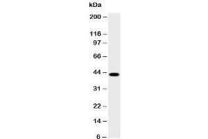 Western blot testing of HSD17B2 antibody and human placenta lysate