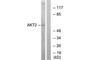 Western blot analysis of extracts from A2780 cells, treated with TNF-alpha, using Akt2 (Ab-474) Antibody. (AKT2 anticorps  (AA 432-481))