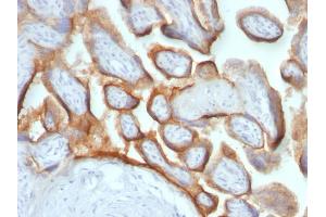 Formalin-fixed, paraffin-embedded human Placenta stained with hCG beta Mouse Monoclonal Antibody (HCGb/54 + HCGb/459). (CGB anticorps)