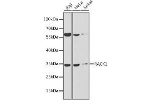 Western blot analysis of extracts of various cell lines, using R antibody (ABIN6131708, ABIN6141226, ABIN6141228 and ABIN6217372) at 1:1000 dilution. (GNB2L1 anticorps  (AA 30-290))