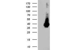 Western Blotting (WB) image for anti-Low Density Lipoprotein Receptor Adaptor Protein 1 (LDLRAP1) antibody (ABIN1496685) (LDLRAP1 anticorps)