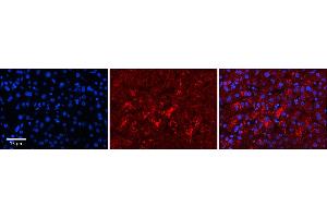 Rabbit Anti-LYPLA2 Antibody  Catalog Number: ARP58638_P050 Formalin Fixed Paraffin Embedded Tissue: Human Adult Liver  Observed Staining: Cytoplasm in hepatocytes, strong signal, low tissue distribution Primary Antibody Concentration: 1:100 Secondary Antibody: Donkey anti-Rabbit-Cy3 Secondary Antibody Concentration: 1:200 Magnification: 20X Exposure Time: 0. (LYPLA2 anticorps  (N-Term))