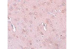 Immunohistochemistry of TRESK in rat brain tissue with this product at 5 μg/ml. (KCNK18 anticorps  (Center))