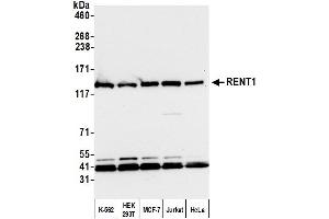Western Blotting (WB) image for anti-UPF1 Regulator of Nonsense Transcripts Homolog (UPF1) (AA 1079-1129) antibody (ABIN7450651)