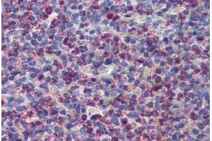 Anti-CYSLTR2 / CYSLT2 antibody  ABIN1048489 IHC staining of human spleen. (CasLTR2 anticorps  (Extracellular Domain))
