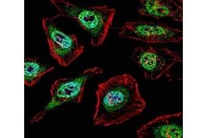 anti-Transcription Factor E3 (TFE3) (AA 1-30) antibody