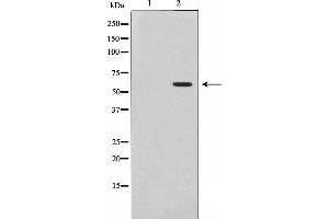 Western blot analysis of Akt phosphorylation expression in Insulin treated 293 whole cell lysates,The lane on the left is treated with the antigen-specific peptide. (AKT1 anticorps  (pThr308))