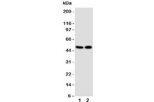 Western blot testing of VDR antibody and Lane 1:  MCF-7;  2: HeLa cell lysate. (Vitamin D Receptor anticorps  (C-Term))