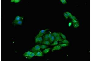 Immunofluorescent analysis of HepG2 cells using ABIN7173917 at dilution of 1:100 and Alexa Fluor 488-congugated AffiniPure Goat Anti-Rabbit IgG(H+L) (TP53INP1 anticorps  (AA 138-205))