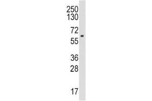 Western blot analysis of CYP19A1 / Aromatase antibody and HL-60 lysate