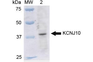 Western blot analysis of Rat Liver cell lysates showing detection of ~42. (KCNJ10 anticorps  (APC))