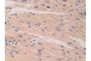 Detection of LAMb2 in Mouse Heart Tissue using Polyclonal Antibody to Laminin Beta 2 (LAMb2)