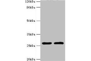 Western blot All lanes: ACRV1 antibody at 4 μg/mL Lane 1: Mouse liver tissue Lane 2: Mouse gonad tissue Secondary Goat polyclonal to rabbit IgG at 1/10000 dilution Predicted band size: 29, 27, 23, 21, 20, 19, 18, 17, 14, 9 kDa Observed band size: 29 kDa (ACRV1 anticorps  (AA 22-265))