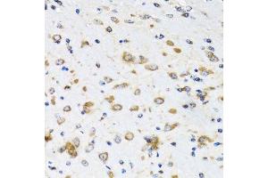 Immunohistochemistry of paraffin-embedded mouse brain using COPB2 antibody. (COPB2 anticorps  (AA 657-906))