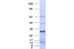 Validation with Western Blot