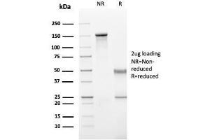 SDS-PAGE Analysis Purified IgG Mouse Recombinant Monoclonal Antibody (rIG266). (Recombinant IGHG anticorps)