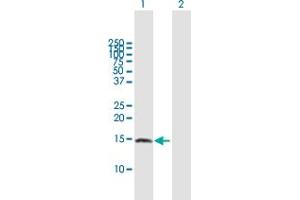 Western Blot analysis of ZNRD1 expression in transfected 293T cell line by ZNRD1 MaxPab polyclonal antibody. (ZNRD1 anticorps  (AA 1-126))
