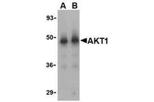 Western blot analysis of Akt1 in human liver cell lysate with AP30042PU-N Akt1 antibody at (A) 1 and (B) 2 μg/ml. (AKT1 anticorps)