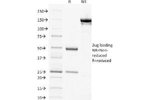 SDS-PAGE Analysis Purified Thymidylate Synthase Mouse Monoclonal Antibody (TYMS/1884).