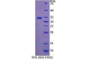 SDS-PAGE analysis of Mouse PTGFRN Protein. (PTGFRN Protéine)