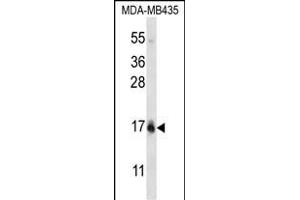 HIST1H2BC/HIST1H2BF Antibody (N-term) (ABIN656773 and ABIN2845992) western blot analysis in MDA-M cell line lysates (35 μg/lane). (HIST1H2BC,HIST1H2BF (AA 1-30), (N-Term) anticorps)