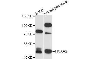 Western blot analysis of extracts of various cell lines, using HOXA2 antibody (ABIN5995946) at 1/1000 dilution.