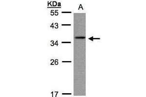 WB Image Sample(30 ug whole cell lysate) A:A431, 12% SDS PAGE antibody diluted at 1:1000 (CRYGC anticorps)