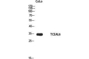 Western Blot (WB) analysis of CoLo using TCEAL6 antibody. (TCEAL6 anticorps)