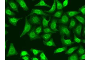 Immunofluorescence analysis of A549 cells using XRCC2 antibody (ABIN5970910). (XRCC2 anticorps)