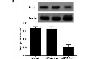 Silencing of Srx-1 accelerated cell injury upon SI/R(A and B) Following transfection with Srx-1 siRNA or siRNA-con, the mRNA and protein levels of Srx-1 were detected.