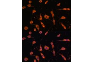 Immunofluorescence analysis of L929 cells using STING/TMEM173 antibody (ABIN1683049, ABIN3017833, ABIN3017834 and ABIN6220283) at dilution of 1:100.