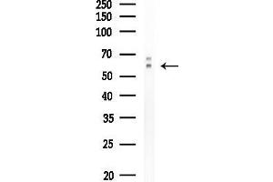 Western blot analysis of lysates from COLO205 cells, using Phospho-Smad1 (Ser187) Antibody at 1/1000 dilution.
