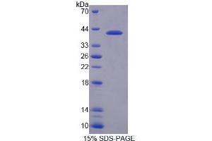 SDS-PAGE analysis of Human NCOR1 Protein. (NCOR1 Protéine)