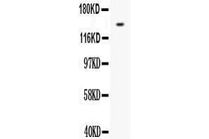 Anti- FLT1 antibody, Western blottingAll lanes: Anti VEGF Receptor 1  at 0.