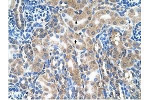 ABP1 antibody was used for immunohistochemistry at a concentration of 4-8 ug/ml to stain Epithelial cells of renal tubule (arrows) in Human Kidney. (DAO anticorps  (C-Term))